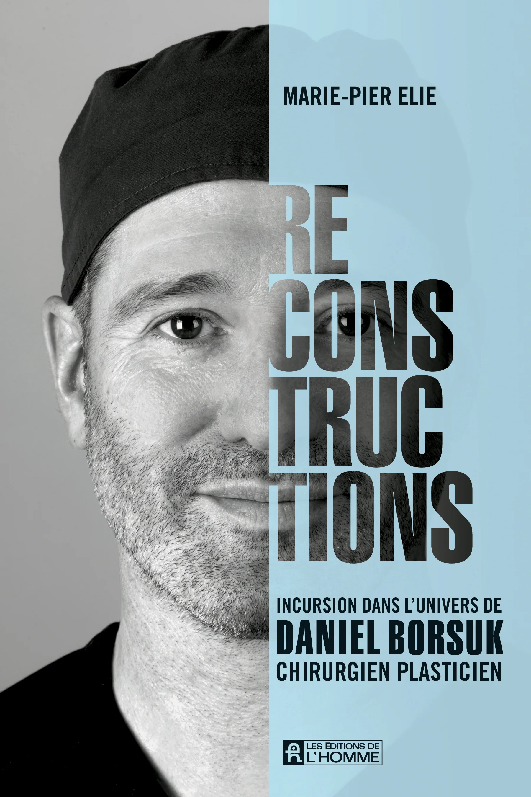 Reconstructions